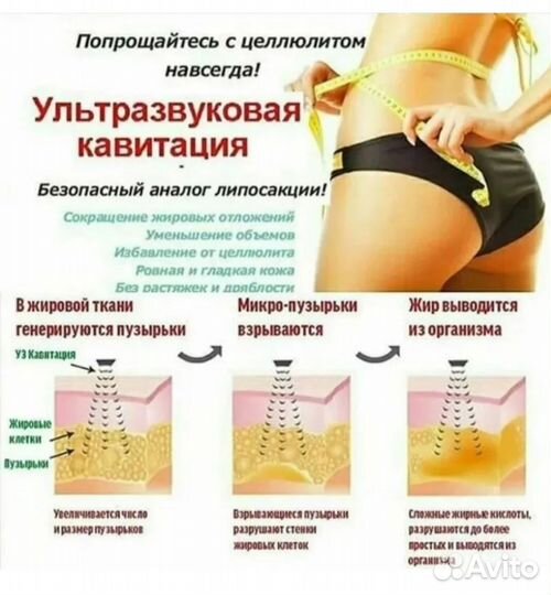 Вакуумный массаж, Кавитация, лазерный липолиз