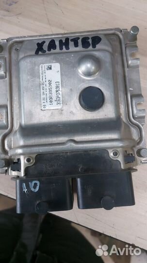 Эбу мозги на УАЗ