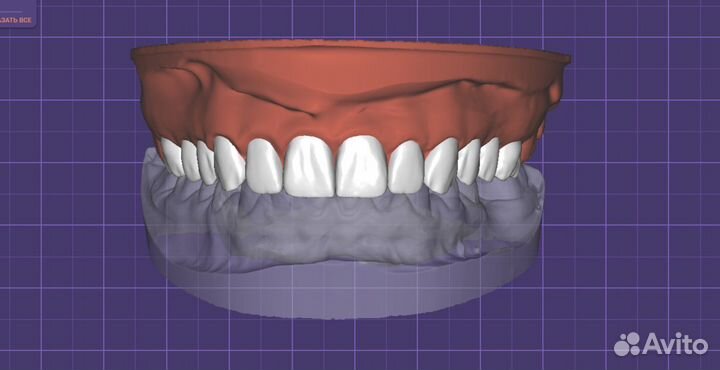 Моделирование в exocad зубной техник CAD CAM