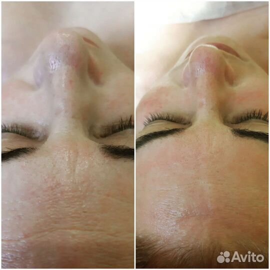 Массаж тела