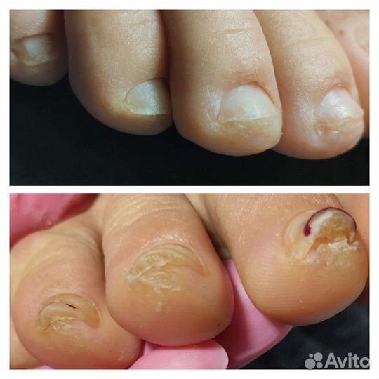 Педикюр/маникюр с выездом на дом любой сложности