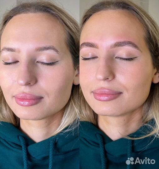 Брови Бугры