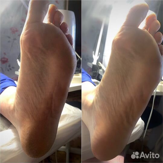 Смарт педикюр, маникюр