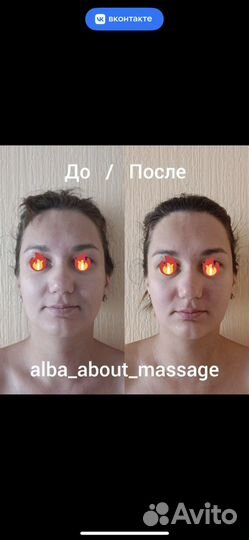 Массаж лица Сплит