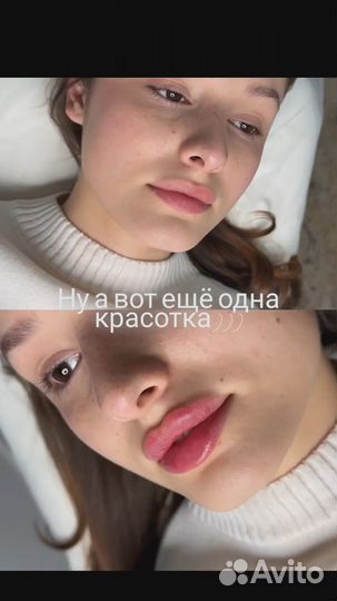 Услуги косметолога губы