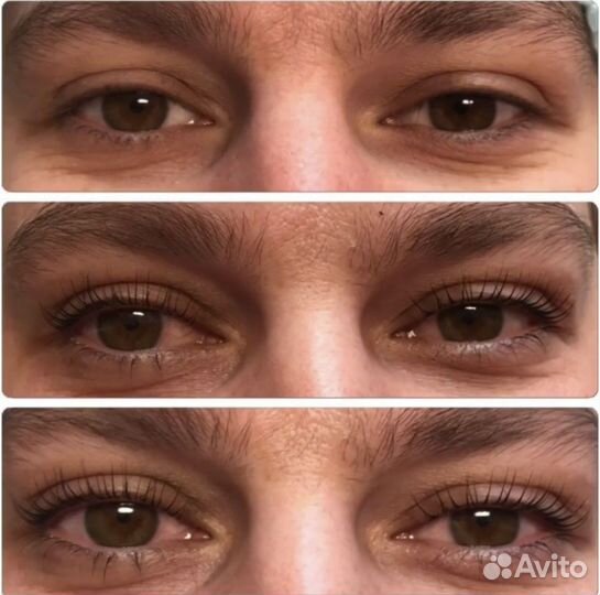 Ламинирование ресничек, ботокс