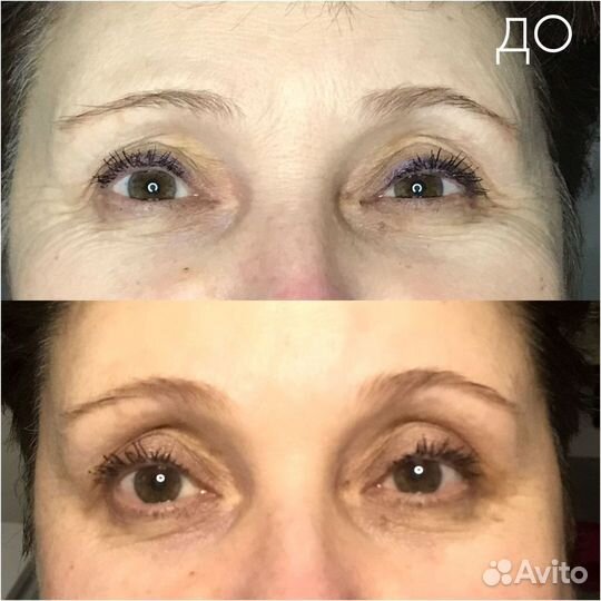 Эко косметолог/ массаж лица и тела