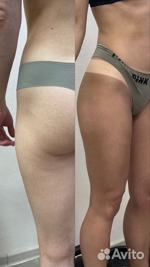 Моментальный загар