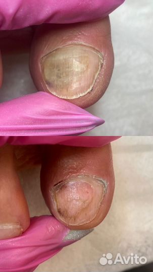 Услуги подолога