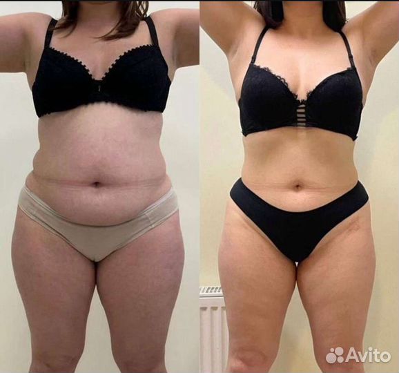 Массаж-Коррекция фигуры