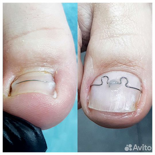 Подолог. Педикюр. Маникюр