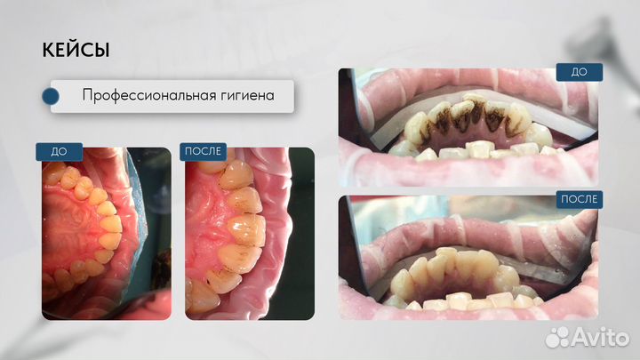 Врач стоматолог терапевт