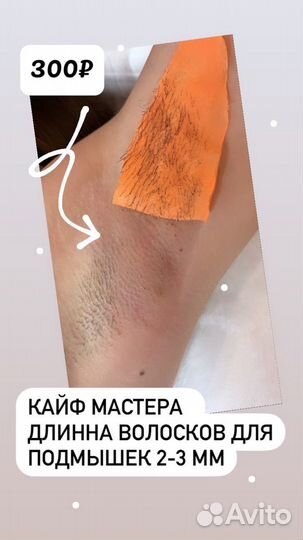 Шугаринг: глубокое бикини