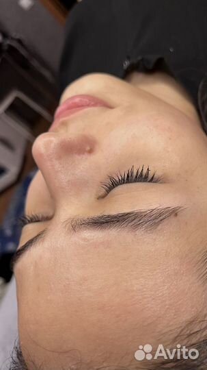 Косметолог чистка лица+пилинги