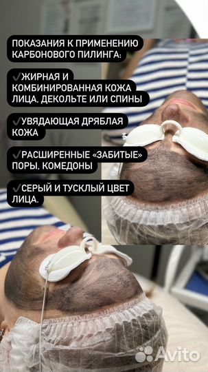 Чистка лица