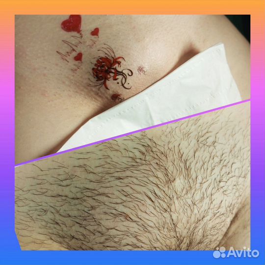 Шугаринг депиляция