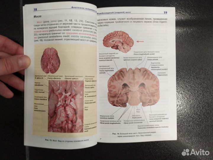Фотографический атлас головного мозга