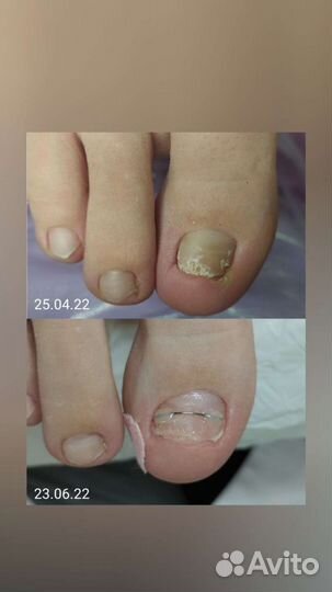 Подолог - Маникюр - Педикюр