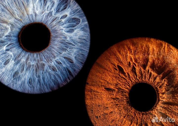 Фото радужки глаз 