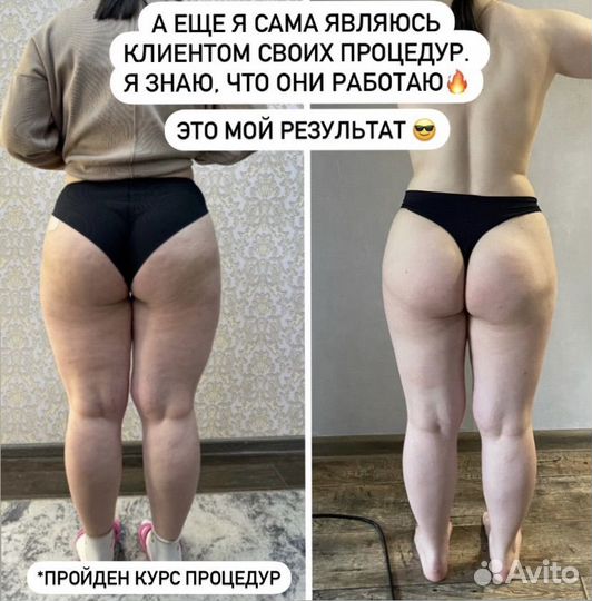 LPG массаж + кавитация