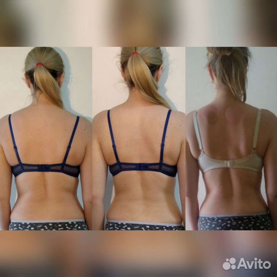 Лимфодренажный массаж