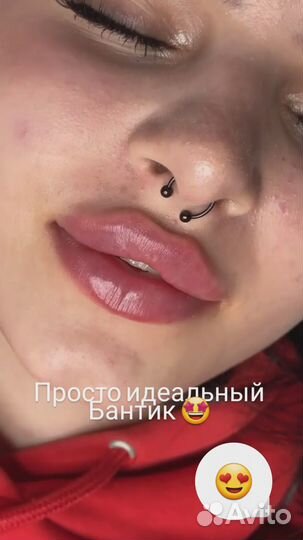 Услуги косметолога губы