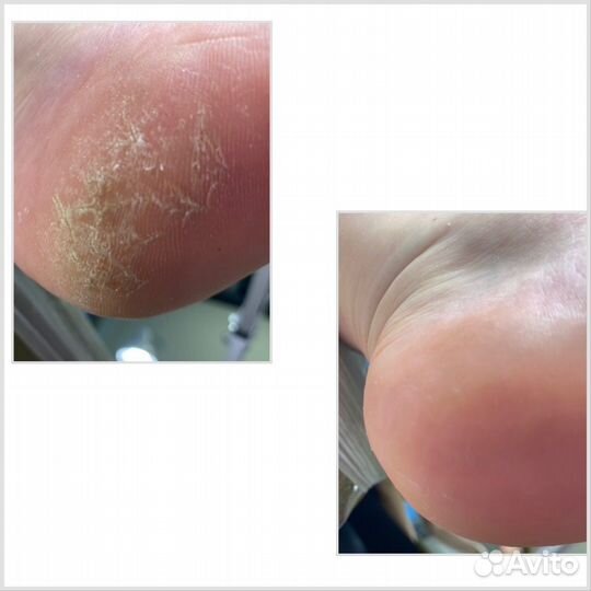 Маникюр педикюр на дому