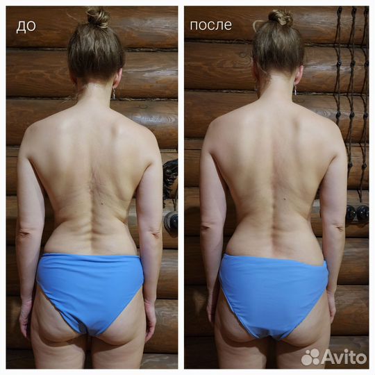 Массаж, коррекция осанки (сколиоз, кифоз, лордоз)