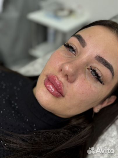 Губы,Косметолог,Увеличение губ,Нужны модели