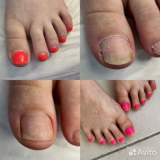 Маникюр, педикюр
