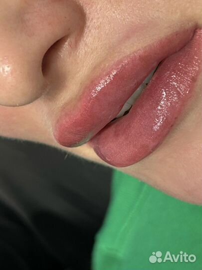 Перманентный макияж, лазерное удаление