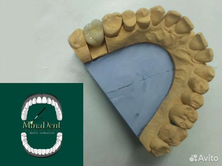 Зубной техник керамист