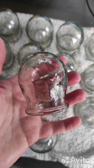 Медицинские вакуумные банки СССР цена за все