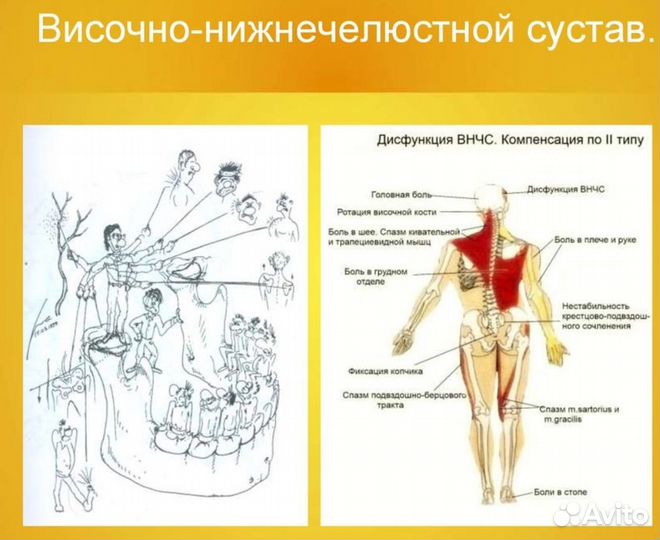 Кинезиомассаж