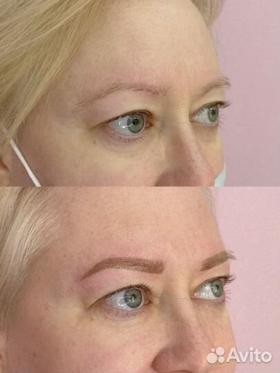 Перманентный макияж. Удаление