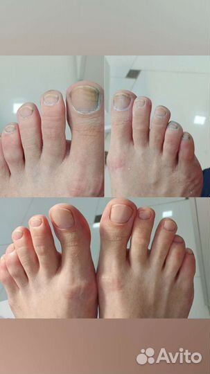 Маникюр,педикюр,наращивание