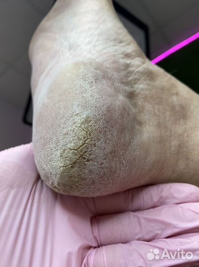 Педикюр SMART