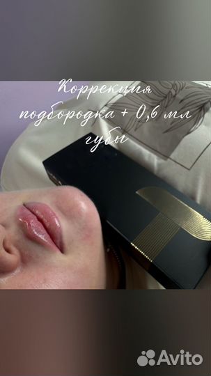 Увеличение губ