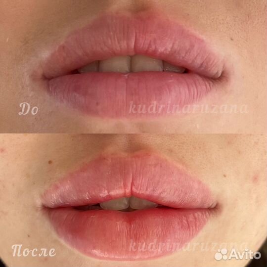 Услуги косметолога