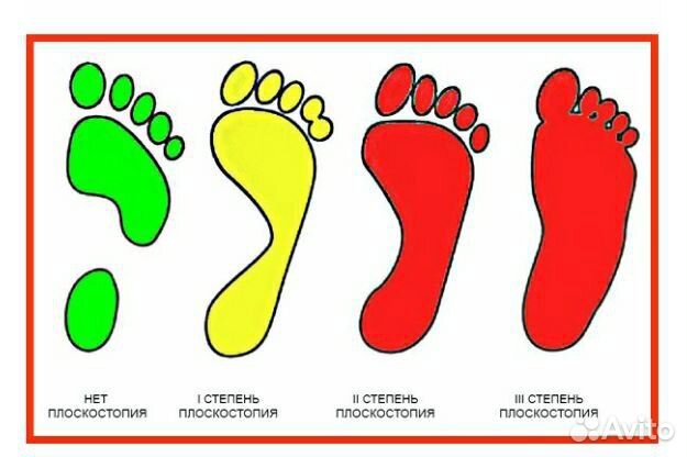 Ортопедические зимние стельки l натуральная шерсть