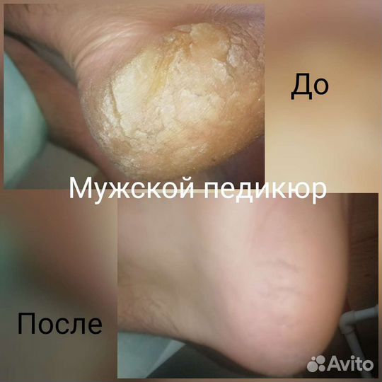 Маникюр, педикюр, оформление бровей