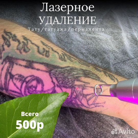 Удаление тату и Перманента