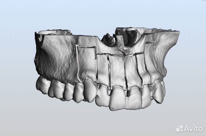 3Diagnosys Plastycad программа