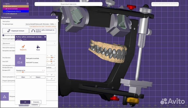 Моделировка в Exocad