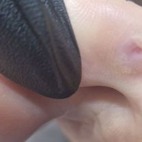Услуги подолога Петергоф, Петергоф