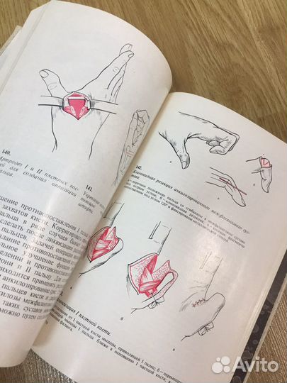 Книги по лечению ожогов, отморожений