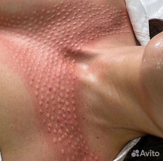 Врач косметолог