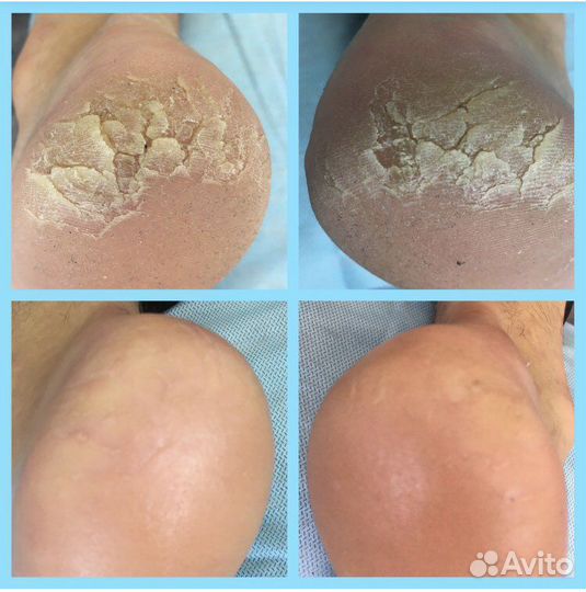 Педикюр маникюр подолог выезд на дом