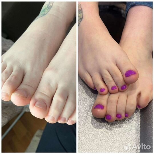 Педикюр на дому