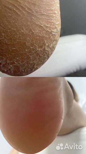 Модель на педикюр бесплатно
